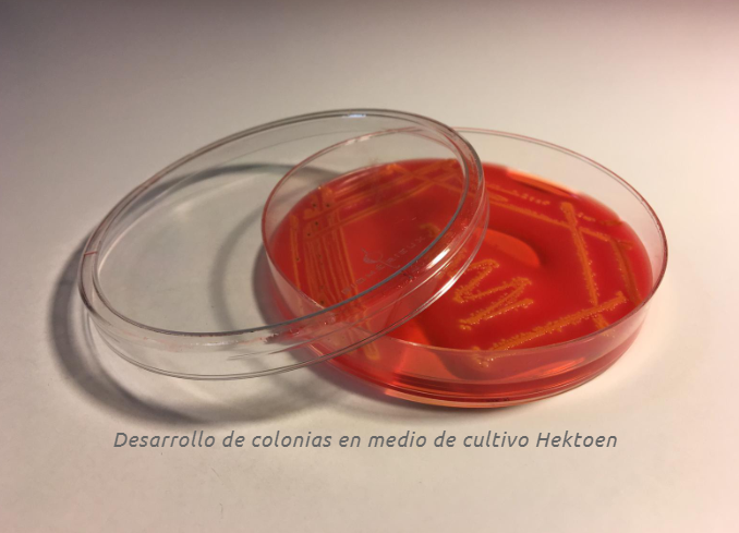 Desarrollo de colonias en medio de cultivo Hektoen – CEyDES